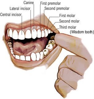 wisdom_tooth